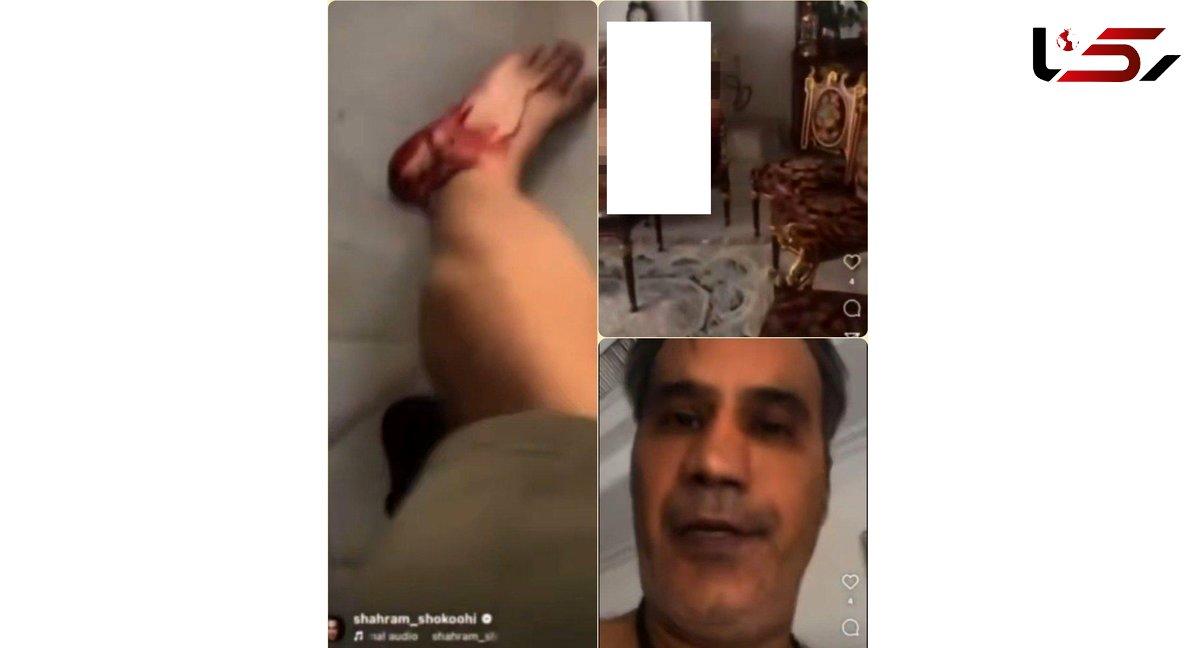 لحظات درگیری خونین خواننده سرشناس با همسرش لحظات درگیری خونین خواننده سرشناس با همسرش