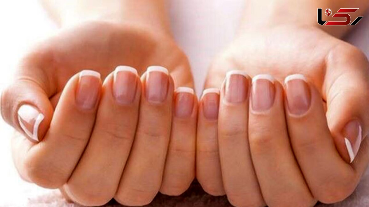 پشت پرده پول خواستن خانوادههای کمیته امداد و بهزیستی برای کاشت ناخن چیست؟ پشت پرده پول خواستن خانوادههای کمیته امداد و بهزیستی برای کاشت ناخن چیست؟