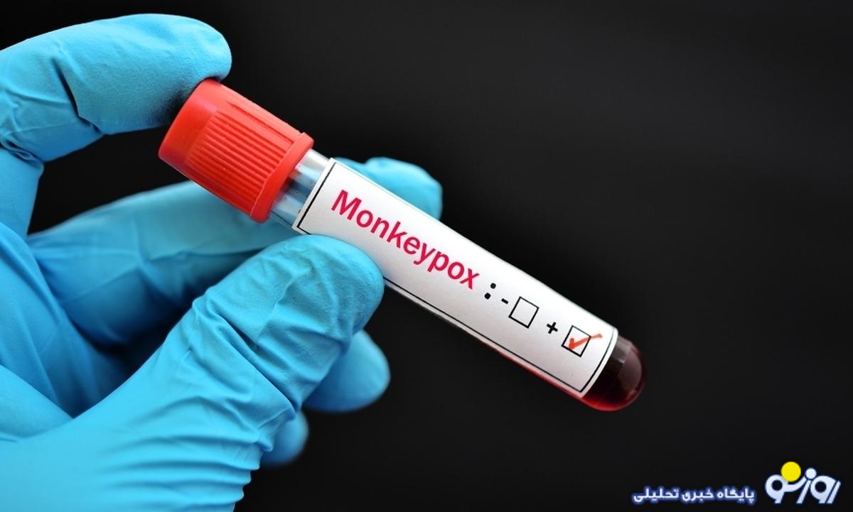 اعلام وضعیت هشدار؛ آبله میمونی درمان ندارد اعلام وضعیت هشدار؛ آبله میمونی درمان ندارد