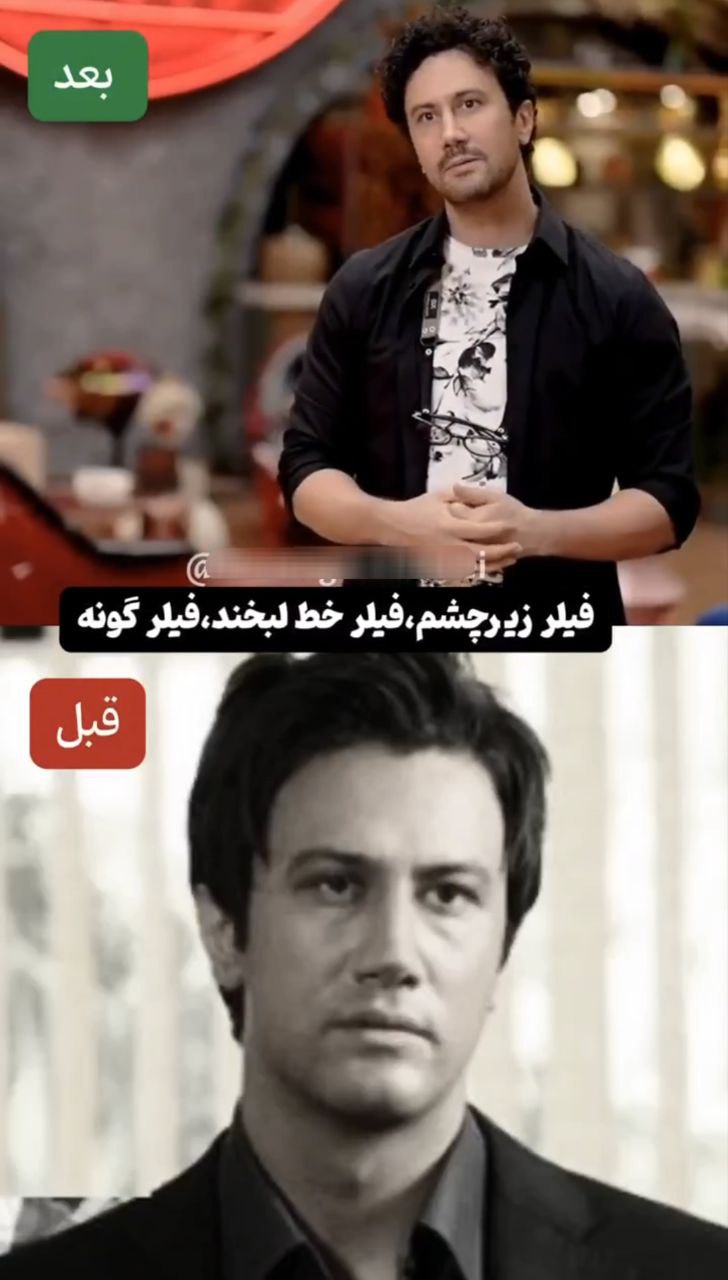 تغییر چهره بهزاد سریال دلنوازان توجهبرانگیز شد