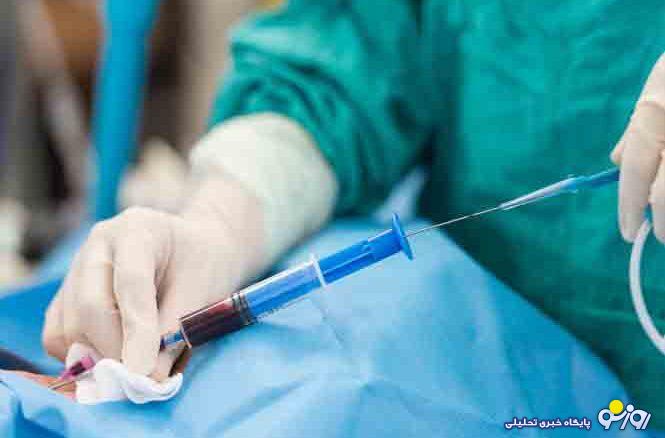 آنژیوگرافی قلب چیست و چگونه انجام میشود؟ آنژیوگرافی قلب چیست و چگونه انجام میشود؟