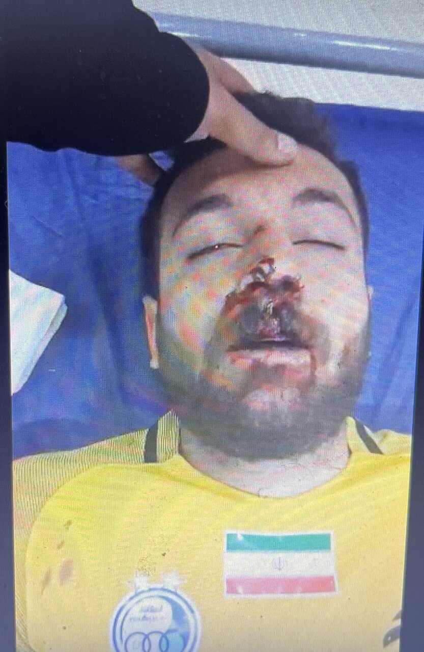 عکس | گلر استقلالی در اتاق عمل/مصدومیت خیلی شدید بود!