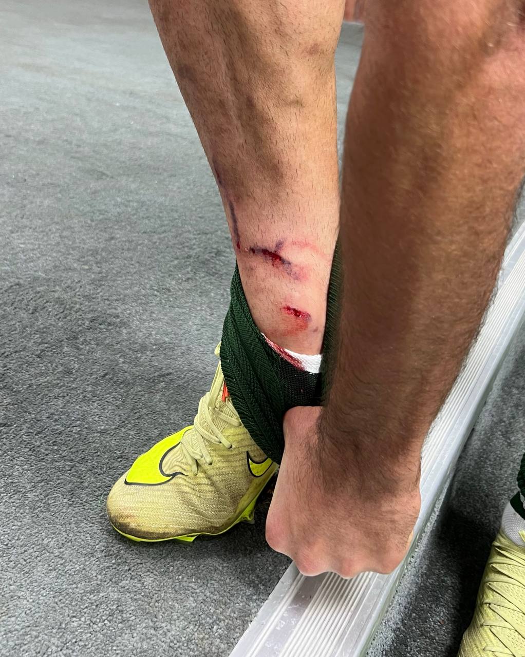 آلومینیوم اراک - پرسپولیس - لیگ برتر - فوتبال ایران