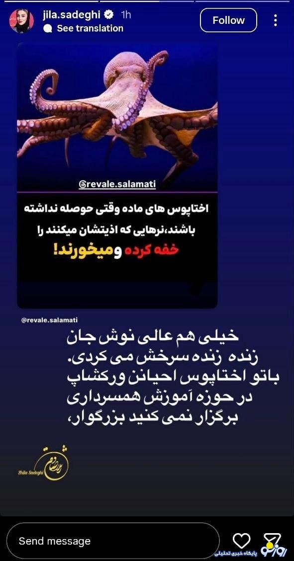 عکسی که باز ژیلا صادقی را سر زبان‌ها نداخت!